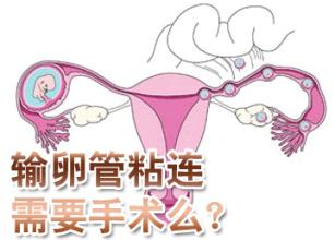 昌吉看输卵管不孕哪家好!