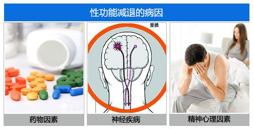 性欲障碍都有哪几种类型