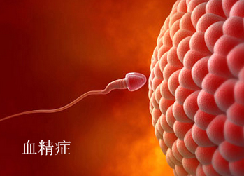 男性出现血精症是什么原因