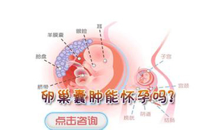 昌吉卵巢囊肿要做哪些检查