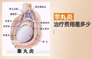 男性睾丸炎危害有哪些