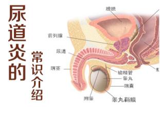尿道炎对男性有什么害处