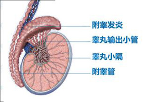 男性睾丸炎会出现哪些症状